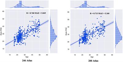 Accelerated Brain Aging in Patients With Obsessive-Compulsive Disorder